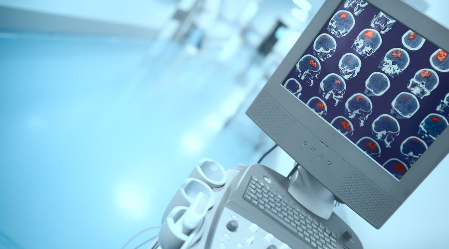 Alzheimer araştırmalarında yeni keşif: Riski artıran genetik varyant bulundu